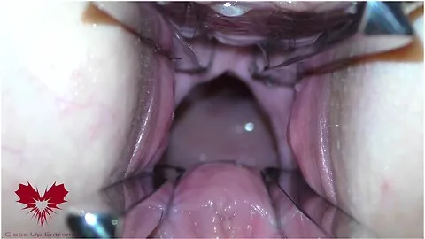 Preview supplied for The Mistress Cunt Is Opened With A Hole Expander So That You Can Study Her Cervix