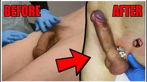 Preview supplied for Dick Wax Depilation By Cute Esthetician. Before And After