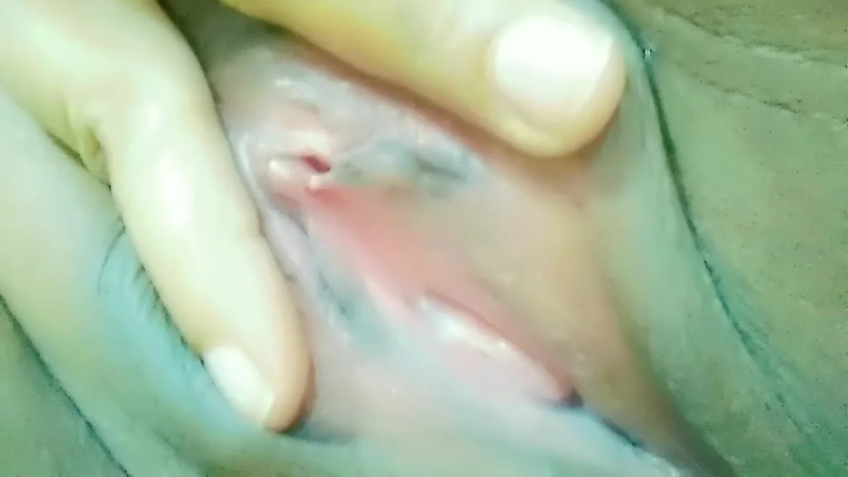 Preview supplied for White Pussy Discharge